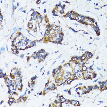 ATG7 Rabbit Polyclonal Antibody