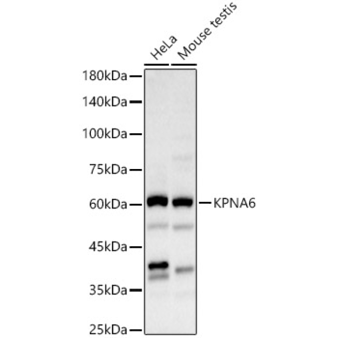 KPNA6 Rabbit Polyclonal Antibody