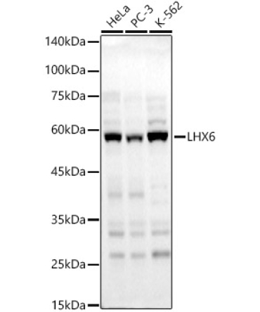 LHX6 Rabbit Polyclonal Antibody
