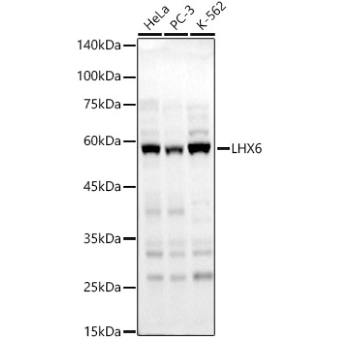LHX6 Rabbit Polyclonal Antibody