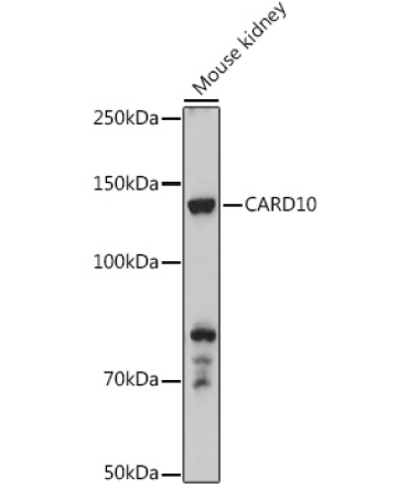 CARD10 Rabbit Polyclonal Antibody