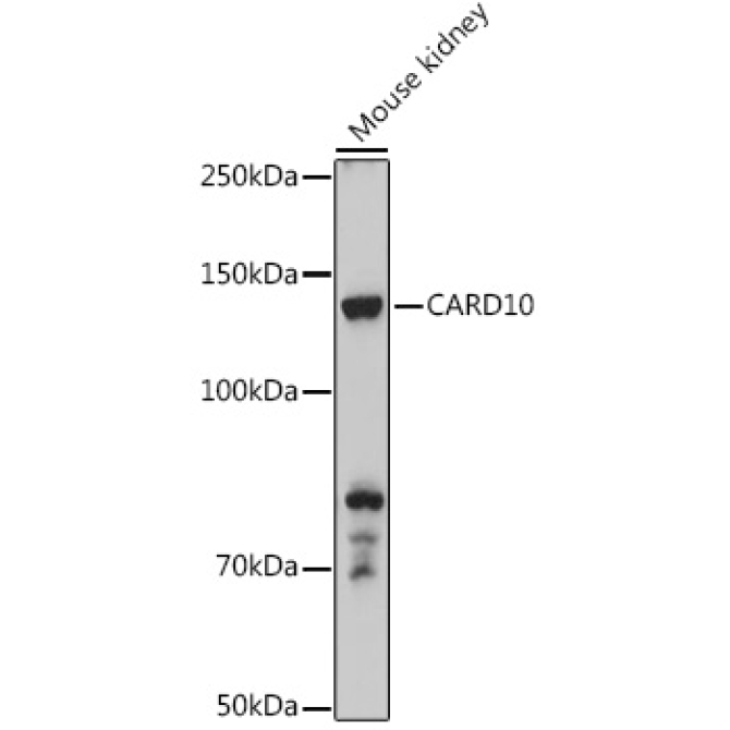 CARD10 Rabbit Polyclonal Antibody