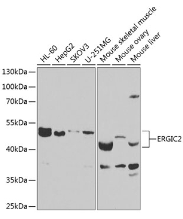 ERGIC2 Rabbit Polyclonal Antibody