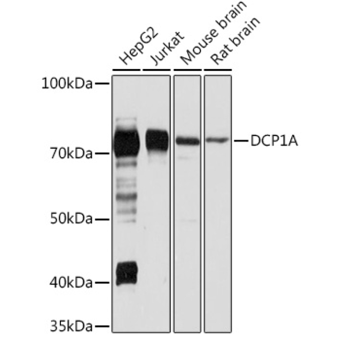 DCP1A Rabbit Polyclonal Antibody