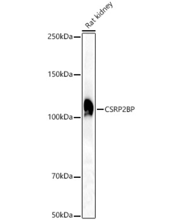 CSRP2BP Rabbit Polyclonal Antibody