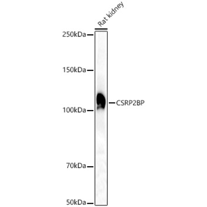 CSRP2BP Rabbit Polyclonal Antibody