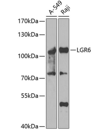 LGR6 Rabbit Polyclonal Antibody