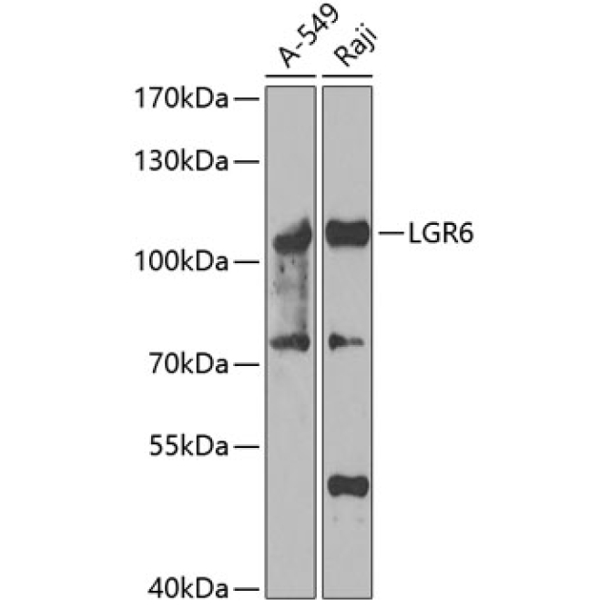 LGR6 Rabbit Polyclonal Antibody