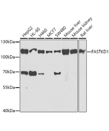 FASTKD1 Rabbit Polyclonal Antibody