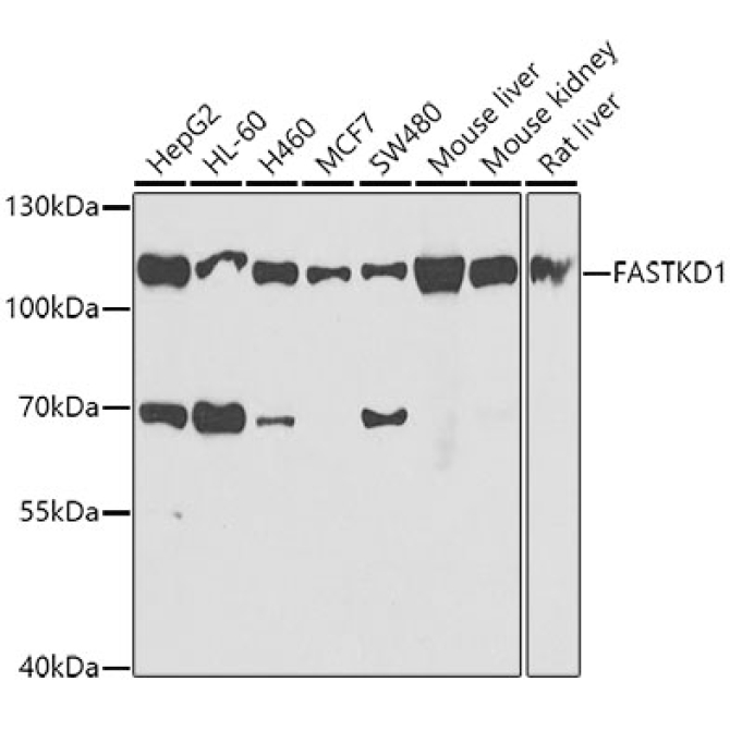 FASTKD1 Rabbit Polyclonal Antibody