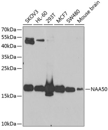 NAA50 Rabbit Polyclonal Antibody