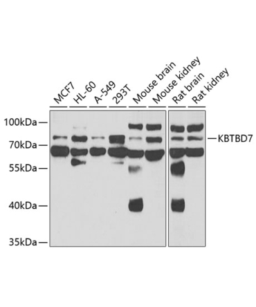 KBTBD7 Rabbit Polyclonal Antibody