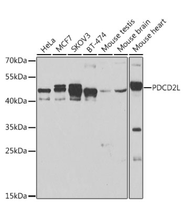 PDCD2L Rabbit Polyclonal Antibody