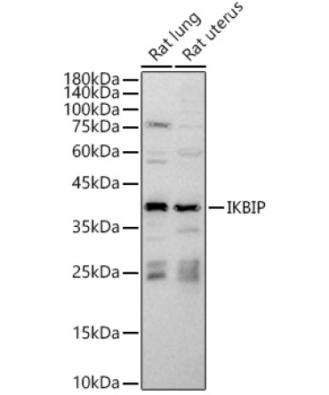 IKBIP Rabbit Polyclonal Antibody