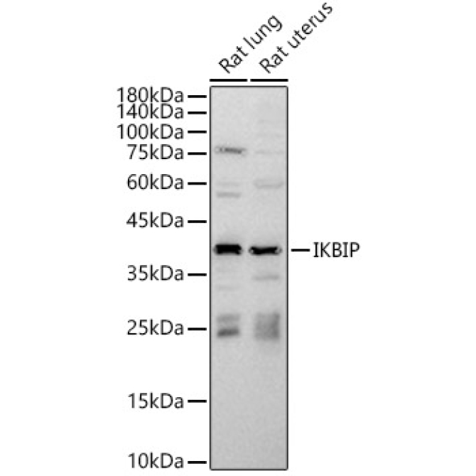 IKBIP Rabbit Polyclonal Antibody