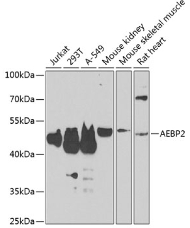 AEBP2 Rabbit Polyclonal Antibody