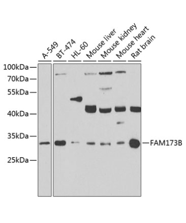 FAM173B Rabbit Polyclonal Antibody