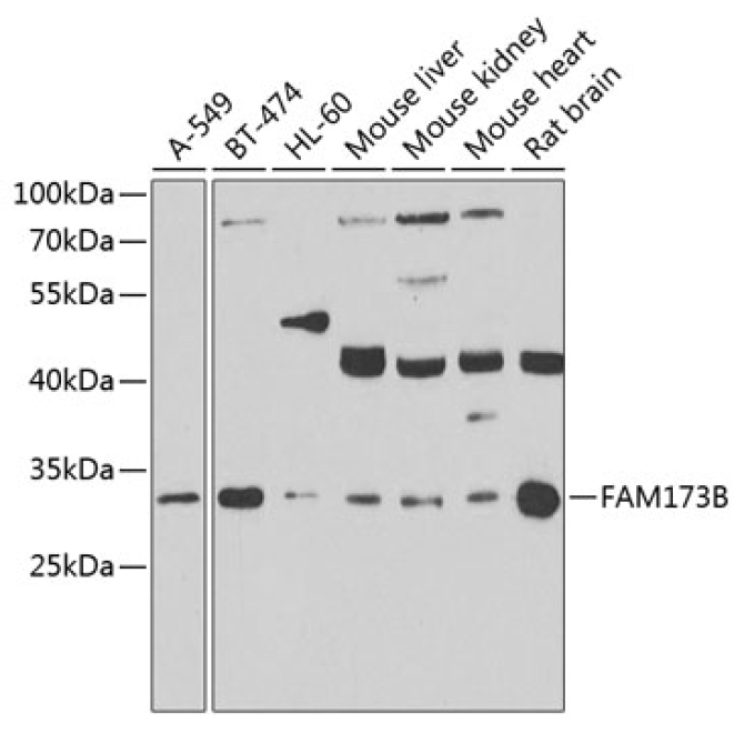 FAM173B Rabbit Polyclonal Antibody