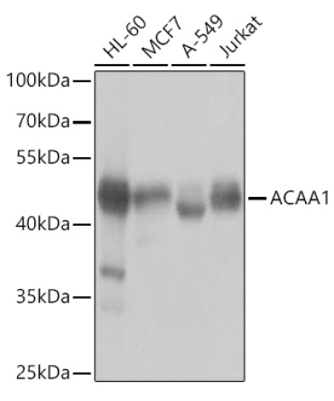 ACAA1 Rabbit Polyclonal Antibody
