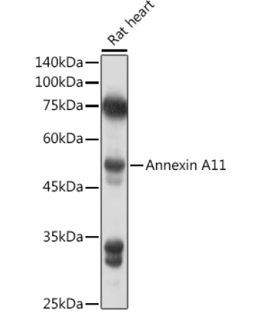 Annexin A11  Rabbit Polyclonal Antibody