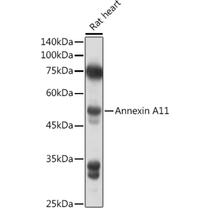 Annexin A11  Rabbit Polyclonal Antibody