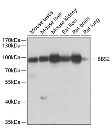 BBS2 Rabbit Polyclonal Antibody