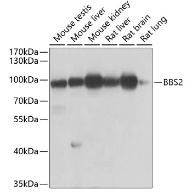 BBS2 Rabbit Polyclonal Antibody