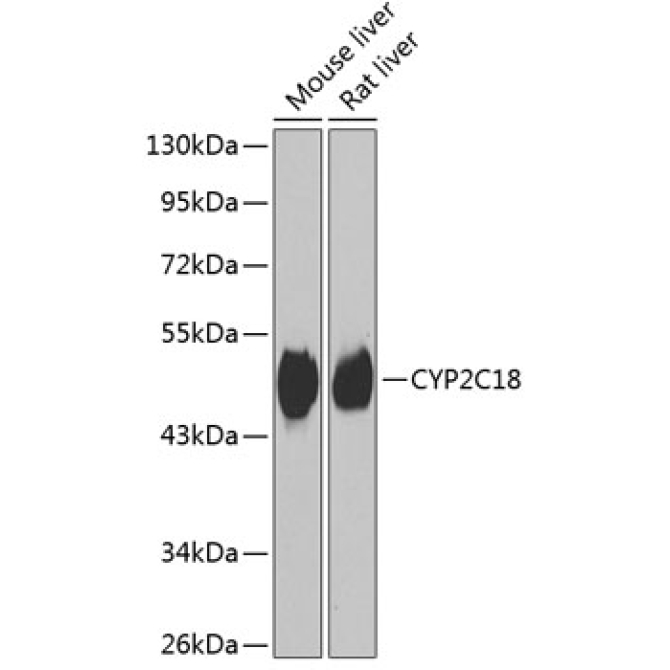 CYP2C18 Rabbit Polyclonal Antibody