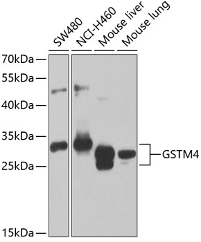GSTM4 Rabbit Polyclonal Antibody