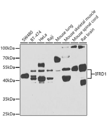 IFRD1 Rabbit Polyclonal Antibody