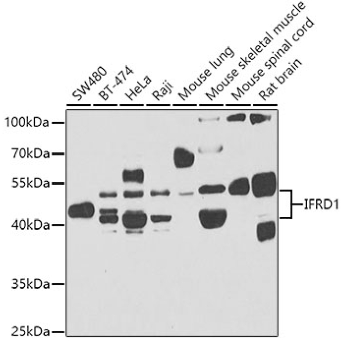 IFRD1 Rabbit Polyclonal Antibody
