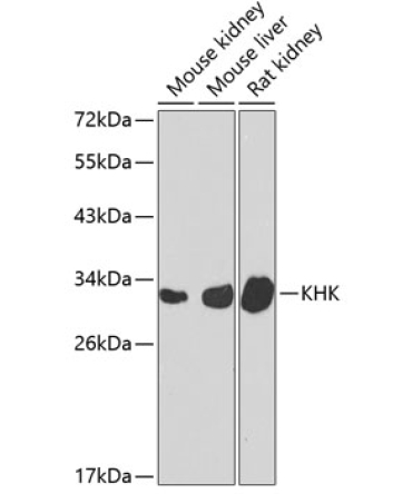 KHK Rabbit Polyclonal Antibody