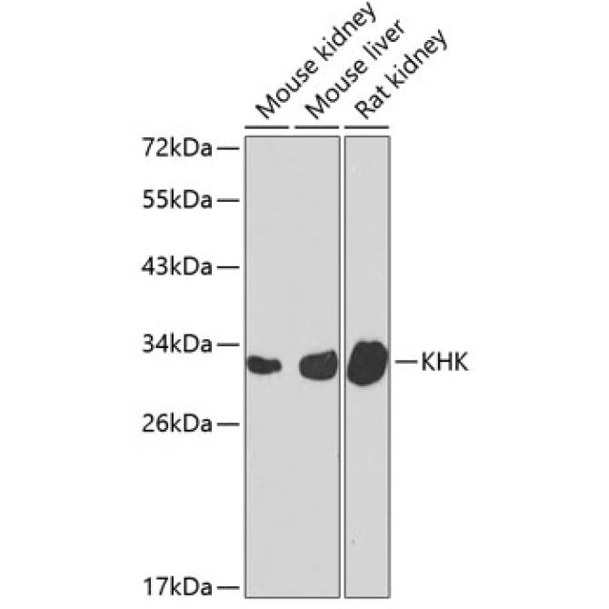 KHK Rabbit Polyclonal Antibody