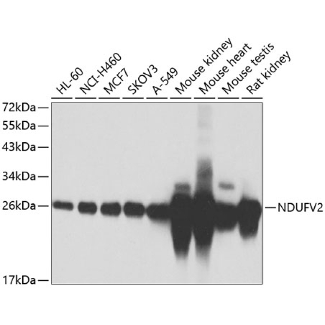 NDUFV2 Rabbit Polyclonal Antibody