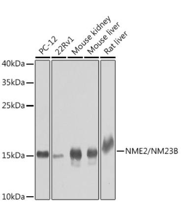 NME2/NM23B Rabbit Polyclonal Antibody