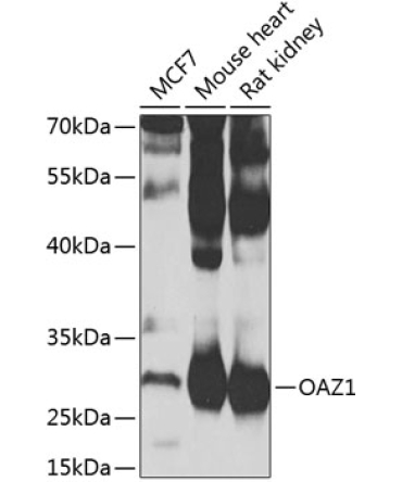 OAZ1 Rabbit Polyclonal Antibody