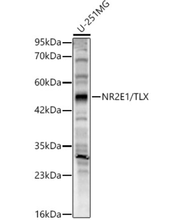 NR2E1/TLX Rabbit Polyclonal Antibody