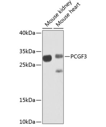 PCGF3 Rabbit Polyclonal Antibody