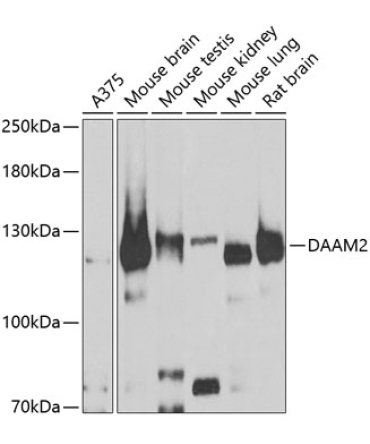 DAAM2 Rabbit Polyclonal Antibody