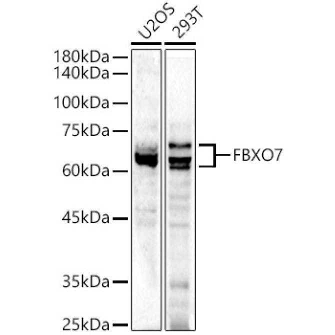 FBXO7 Rabbit Polyclonal Antibody