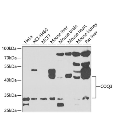COQ3 Rabbit Polyclonal Antibody