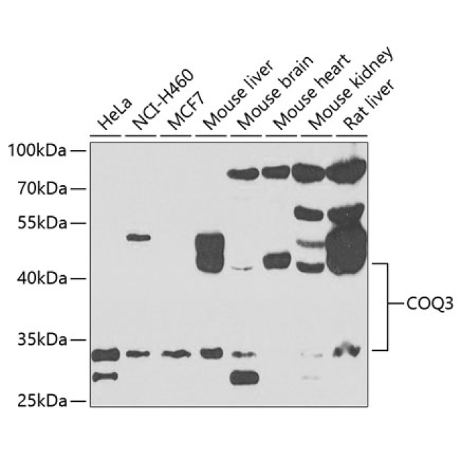 COQ3 Rabbit Polyclonal Antibody