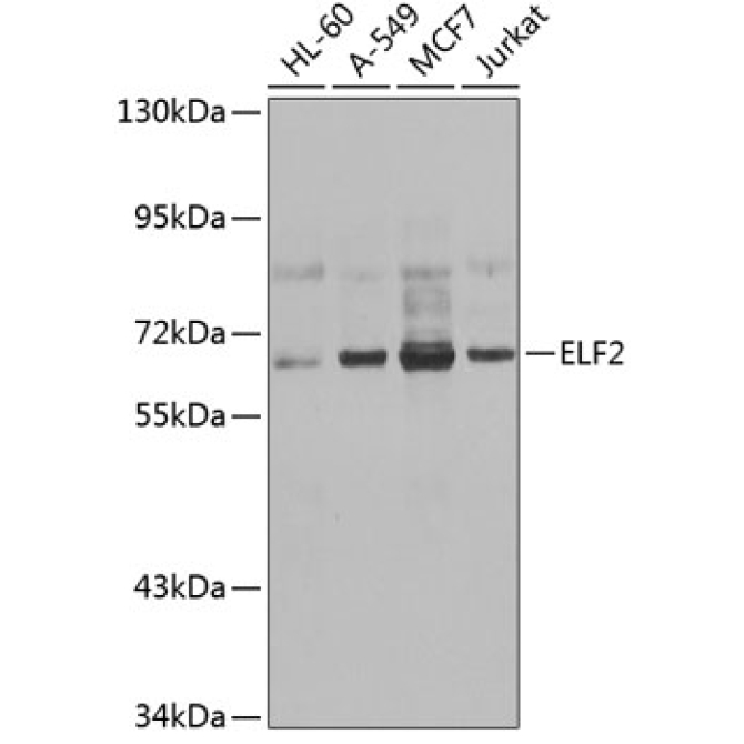 ELF2 Rabbit Polyclonal Antibody