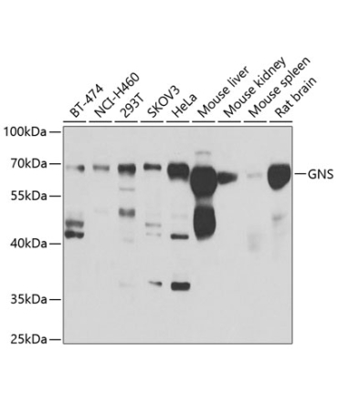 GNS Rabbit Polyclonal Antibody