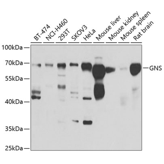 GNS Rabbit Polyclonal Antibody