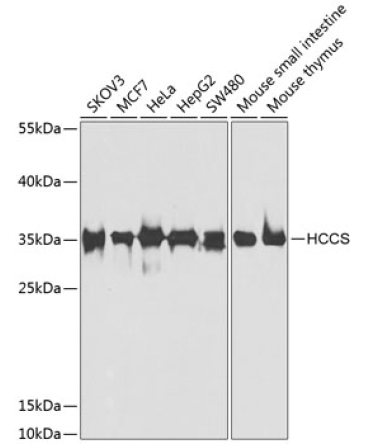HCCS Rabbit Polyclonal Antibody