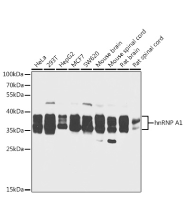 hnRNP A1 Rabbit Polyclonal Antibody