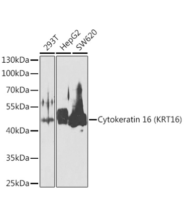 Cytokeratin 16 (KRT16) Rabbit Polyclonal Antibody
