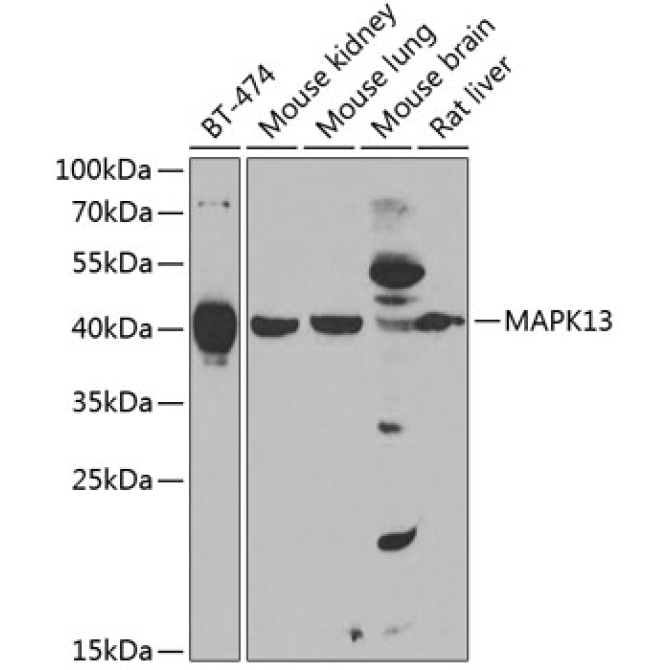 MAPK13 Rabbit Polyclonal Antibody