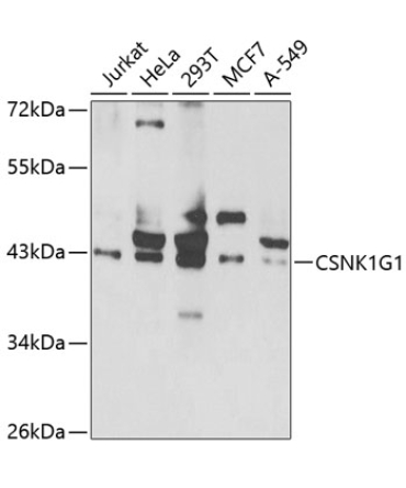 CSNK1G1 Rabbit Polyclonal Antibody